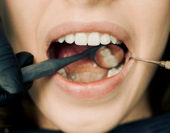 Clinica dentara Elveto Dent